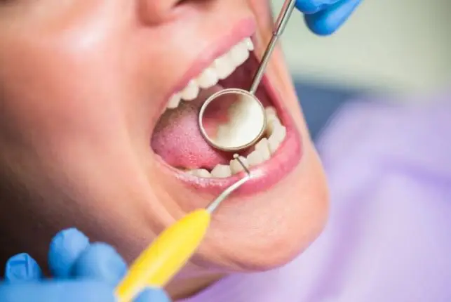 Timely Dental Fillings