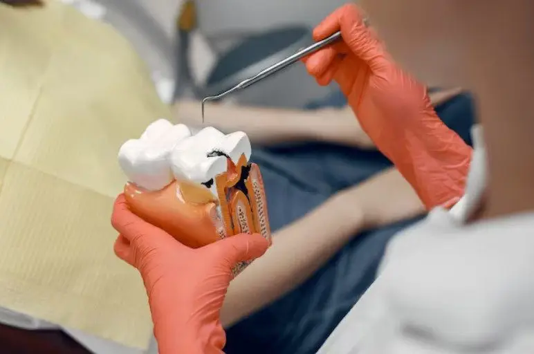 Dentist in Clermont FL showing Root Canal Treatment